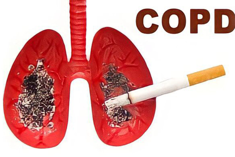 Thuốc lá và nguy cơ mắc bệnh phổi tắc nghẽn mãn tính